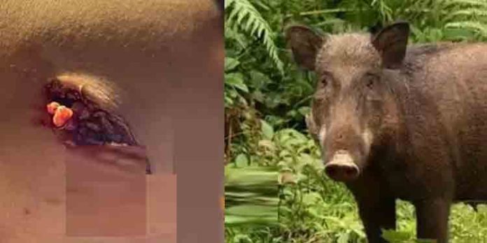 തിരുവോണത്തിന് പൂവ് പറിക്കുന്നതിനിടയില് കാട്ടുപന്നിയുടെ കുത്തേറ്റ് പരിക്ക് തിരുവോണത്തിന് പൂവ് പറിക്കുന്നതിനിടയില് കാട്ടുപന്നിയുടെ കുത്തേറ്റ് പരിക്ക്