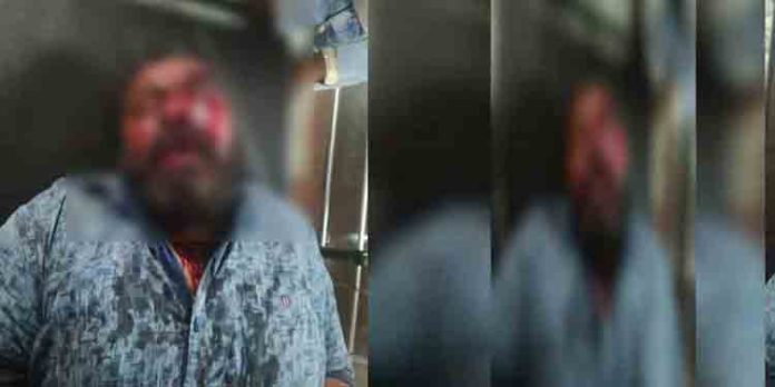 സി പി ഐ എം ബ്രാഞ്ച് സെക്രട്ടറിക്ക് നേരെ ആക്രമണം സി പി ഐ എം ബ്രാഞ്ച് സെക്രട്ടറിക്ക് നേരെ ആക്രമണം