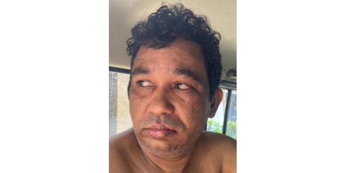 വാക്കുതർക്കത്തെതുടർന്ന് തലയ്ക്ക് വെട്ടേറ്റ് യുവാവിന് ഗുരുതര പരിക്ക് വാക്കുതർക്കത്തെതുടർന്ന് തലയ്ക്ക് വെട്ടേറ്റ് യുവാവിന് ഗുരുതര പരിക്ക്