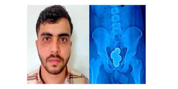കസ്റ്റംസിനെ വെട്ടിച്ച് പുറത്തു കടത്താന് ശ്രമിച്ച ഒരുകിലോ സ്വര്ണം പിടികൂടി കസ്റ്റംസിനെ വെട്ടിച്ച് പുറത്തു കടത്താന് ശ്രമിച്ച ഒരുകിലോ സ്വര്ണം പിടികൂടി