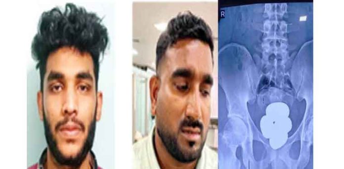 കോഴിക്കോട് അന്താരാഷ്ട്രവിമാനത്താവളത്തില് 1676.1. ഗ്രാം സ്വര്ണസംയുക്തം പിടികൂടി കോഴിക്കോട് അന്താരാഷ്ട്രവിമാനത്താവളത്തില് 1676.1. ഗ്രാം സ്വര്ണസംയുക്തം പിടികൂടി