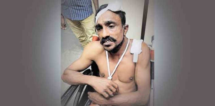 വീടിന് നേരെ കല്ലേറ് ; സമീപവാസികള്ക്ക് പരുക്ക് വീടിന് നേരെ കല്ലേറ് ; സമീപവാസികള്ക്ക് പരുക്ക്