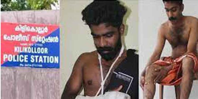 കിളികൊല്ലൂരിലെ പോലീസ് മര്ദിച്ച സംഭവത്തില് സൈന്യത്തിന്റെ ഇടപെടല് കിളികൊല്ലൂരിലെ പോലീസ് മര്ദിച്ച സംഭവത്തില് സൈന്യത്തിന്റെ ഇടപെടല്