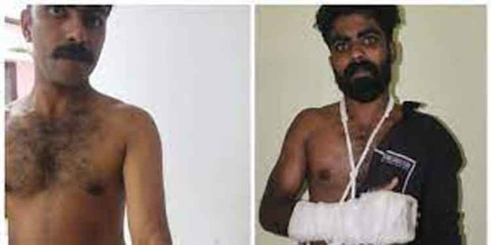 കിളികൊല്ലൂര് പോലീസ് മര്ദന കേസ് : മജിസ്ട്രേട്ടിനെതിരെ പരാതി കിളികൊല്ലൂര് പോലീസ് മര്ദന കേസ് : മജിസ്ട്രേട്ടിനെതിരെ പരാതി
