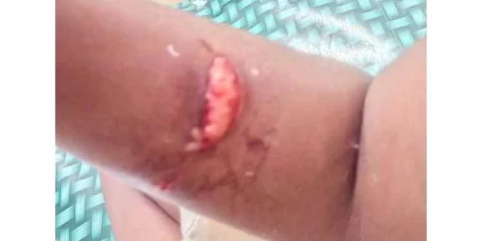 റാന്നിയില് തെരുവ് നായ ആക്രമണം ; നാലാംക്ലാസ്സ് വിദ്യാര്ത്ഥി ഗുരുതരാവസ്ഥയില് റാന്നിയില് തെരുവ് നായ ആക്രമണം ; നാലാംക്ലാസ്സ് വിദ്യാര്ത്ഥി ഗുരുതരാവസ്ഥയില്