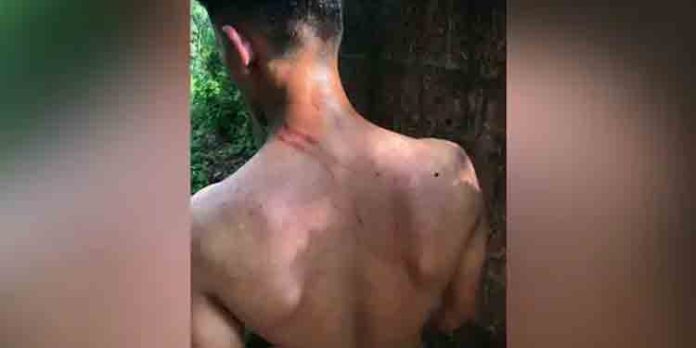 നാദാപുരത്ത് റാഗിങ്ങിൽ വിദ്യാർത്ഥിയുടെ കർണപുടം തകർന്നതായി പരാതി നാദാപുരത്ത് റാഗിങ്ങിൽ വിദ്യാർത്ഥിയുടെ കർണപുടം തകർന്നതായി പരാതി
