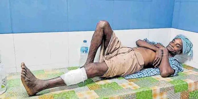 തൊഴിലുറപ്പ് ജോലിക്കിടെ കാട്ടുപന്നിയുടെ ആക്രമണത്തില് തൊഴിലാളിക്ക് പരുക്ക് തൊഴിലുറപ്പ് ജോലിക്കിടെ കാട്ടുപന്നിയുടെ ആക്രമണത്തില് തൊഴിലാളിക്ക് പരുക്ക്