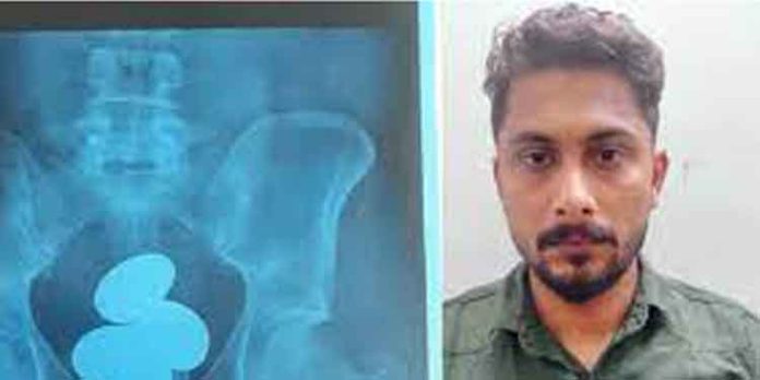 ഒരു കിലോ സ്വർണവുമായി യുവാവ് കരിപ്പൂരിൽ പിടിയിൽ ഒരു കിലോ സ്വർണവുമായി യുവാവ് കരിപ്പൂരിൽ പിടിയിൽ