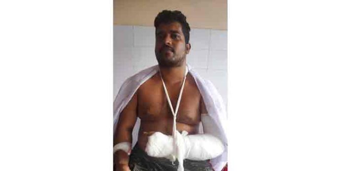 കാട്ടു പന്നിയെ തട്ടി ഓട്ടോ മറിഞ്ഞു ; ഓട്ടോ ഡ്രൈവര്ക്ക് പരിക്ക് കാട്ടു പന്നിയെ തട്ടി ഓട്ടോ മറിഞ്ഞു ; ഓട്ടോ ഡ്രൈവര്ക്ക് പരിക്ക്