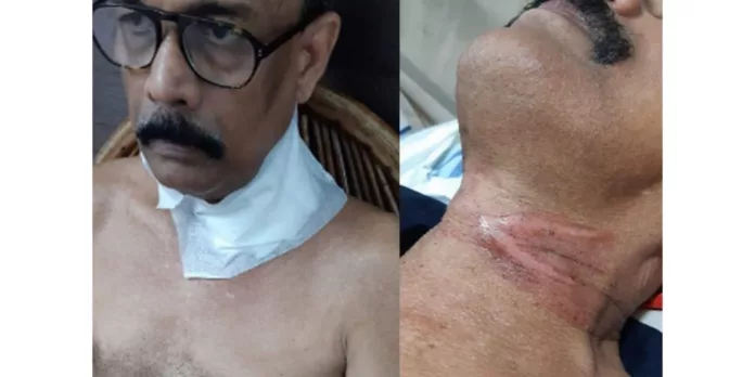 കൊച്ചിയില് കേബിള് കഴുത്തില് കുരുങ്ങി ബൈക്ക് യാത്രക്കാരായ ദമ്പതികള്ക്ക് പരിക്ക് കൊച്ചിയില് കേബിള് കഴുത്തില് കുരുങ്ങി ബൈക്ക് യാത്രക്കാരായ ദമ്പതികള്ക്ക് പരിക്ക്