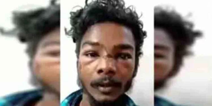 കുടുംബ വഴക്ക് : കൊല്ലം പാരിപ്പള്ളിയില് ഭാര്യാപിതാവിനെ കുത്തിക്കൊലപ്പെടുത്താന് ശ്രമിച്ചയാള് അറസ്റ്റില് കുടുംബ വഴക്ക് : കൊല്ലം പാരിപ്പള്ളിയില് ഭാര്യാപിതാവിനെ കുത്തിക്കൊലപ്പെടുത്താന് ശ്രമിച്ചയാള് അറസ്റ്റില്