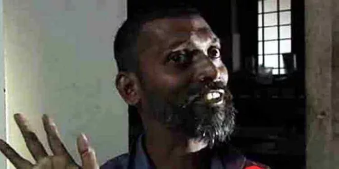 കേബിള് കഴുത്തില് കുരുങ്ങി ഗുരുതരമായി പരിക്കേറ്റ ഭിന്നശേഷിക്കാരനെ തിരിഞ്ഞുനോക്കാതെ കോർപ്പറേഷനും ജനപ്രതിനിധികളും കേബിള് കഴുത്തില് കുരുങ്ങി ഗുരുതരമായി പരിക്കേറ്റ ഭിന്നശേഷിക്കാരനെ തിരിഞ്ഞുനോക്കാതെ കോർപ്പറേഷനും ജനപ്രതിനിധികളും