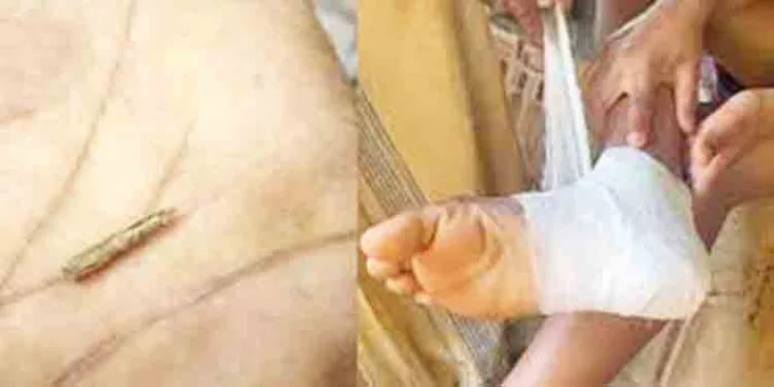 കാലില് തറച്ച മുള്ള് നീക്കം ചെയ്ത് പിതാവ് ; ചികിത്സ നല്കുന്നതില് വീഴ്ച വരുത്തിയെന്ന് ആരോപണം കാലില് തറച്ച മുള്ള് നീക്കം ചെയ്ത് പിതാവ് ; ചികിത്സ നല്കുന്നതില് വീഴ്ച വരുത്തിയെന്ന് ആരോപണം