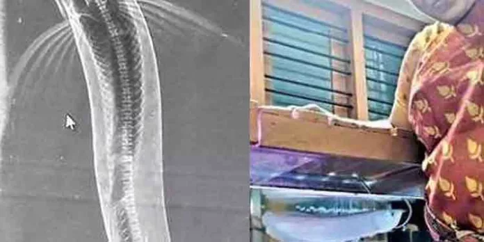 പ്ലാസ്റ്റിക് ബുള്ളറ്റ് വിഴുങ്ങിയ അരോന മത്സ്യത്തിന്റെ എക്സ്റേ എടുത്തു പ്ലാസ്റ്റിക് ബുള്ളറ്റ് വിഴുങ്ങിയ അരോന മത്സ്യത്തിന്റെ എക്സ്റേ എടുത്തു