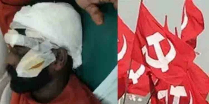 തെരുവിൽ തമ്മിൽ തല്ലി സിപിഎം പ്രവർത്തകർ, രണ്ടുപേർക്ക് പരിക്ക്, അഞ്ച് പേർ അറസ്റ്റിൽ തെരുവിൽ തമ്മിൽ തല്ലി സിപിഎം പ്രവർത്തകർ, രണ്ടുപേർക്ക് പരിക്ക്, അഞ്ച് പേർ അറസ്റ്റിൽ