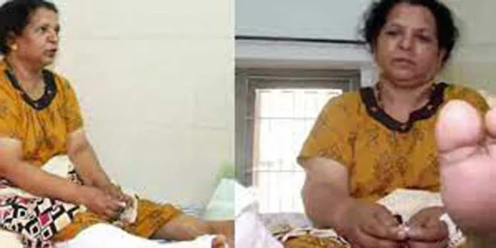കാല് മാറി ശാസ്ത്രക്രിയ നടത്തിയ സംഭവം ; മെഡിക്കൽ ബോർഡിന്റെ യോഗം തുടങ്ങി കാല് മാറി ശാസ്ത്രക്രിയ നടത്തിയ സംഭവം ; മെഡിക്കൽ ബോർഡിന്റെ യോഗം തുടങ്ങി