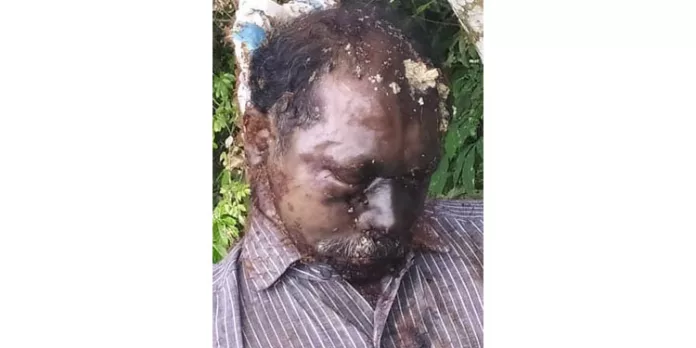 അജ്ഞാത മൃതദേഹം കണ്ടെത്തി അജ്ഞാത മൃതദേഹം കണ്ടെത്തി