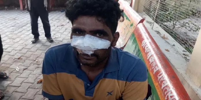 വിവാഹിതയായ യുവതിക്കൊപ്പം ഒളിച്ചോടി ; യുവാവിന്റെ മൂക്ക് മുറിച്ച് മാറ്റി വിവാഹിതയായ യുവതിക്കൊപ്പം ഒളിച്ചോടി ; യുവാവിന്റെ മൂക്ക് മുറിച്ച് മാറ്റി
