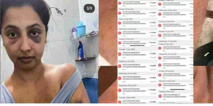 മദ്യലഹരിയിൽ നടി ക്രൂരമായി മർദ്ദിച്ചു, സ്വയം നെഞ്ചത്തടിച്ചു: ആ ഫ്ളാറ്റില് നിന്നും ഞാനോടി രക്ഷപ്പെടുകയായിരുന്നുവെന്ന് കാമുകൻ മദ്യലഹരിയിൽ നടി ക്രൂരമായി മർദ്ദിച്ചു, സ്വയം നെഞ്ചത്തടിച്ചു: ആ ഫ്ളാറ്റില് നിന്നും ഞാനോടി രക്ഷപ്പെടുകയായിരുന്നുവെന്ന് കാമുകൻ
