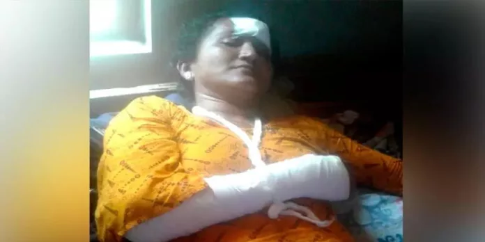 കൊല്ലത്ത് വീട്ടമ്മയെ ആക്രമിച്ച അയല്വാസിയായ സ്ത്രീ റിമാന്ഡില് കൊല്ലത്ത് വീട്ടമ്മയെ ആക്രമിച്ച അയല്വാസിയായ സ്ത്രീ റിമാന്ഡില്