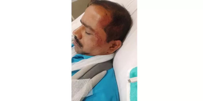 ഹ്യൂമൻ റൈറ്റ്സ് ക്രോപ്സ് ചെയർമാൻ ഷാജി ജേക്കബിന് നേരെ വധശ്രമം ഹ്യൂമൻ റൈറ്റ്സ് ക്രോപ്സ് ചെയർമാൻ ഷാജി ജേക്കബിന് നേരെ വധശ്രമം