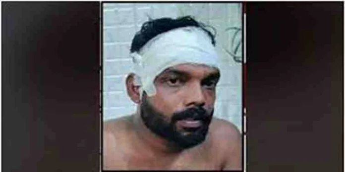 ഡിവൈഎഫ്ഐ നേതാവിനെ തലയ്ക്കടിച്ച് കൊല്ലാന് ശ്രമം ; ആക്രമിച്ചത് എസ്ഡിപിഐ പ്രവര്ത്തകരെന്ന് സിപിഎം ഡിവൈഎഫ്ഐ നേതാവിനെ തലയ്ക്കടിച്ച് കൊല്ലാന് ശ്രമം ; ആക്രമിച്ചത് എസ്ഡിപിഐ പ്രവര്ത്തകരെന്ന് സിപിഎം