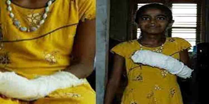 കൈപ്പത്തിയിലെ മുറിവിന് ചികിത്സിച്ചു ; ഡോക്ടറുടെ അശ്രദ്ധ മൂലം കൈവിരലുകളുടെ ചലനശേഷി നഷ്ടപ്പെട്ടതായി പരാതി കൈപ്പത്തിയിലെ മുറിവിന് ചികിത്സിച്ചു ; ഡോക്ടറുടെ അശ്രദ്ധ മൂലം കൈവിരലുകളുടെ ചലനശേഷി നഷ്ടപ്പെട്ടതായി പരാതി