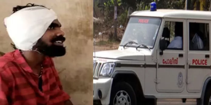 കൊല്ലത്ത് യുവാവിന്റെ ചെവി പോലീസ് ലാത്തി കൊണ്ട് അടിച്ചു തകര്ത്തെന്ന് പരാതി കൊല്ലത്ത് യുവാവിന്റെ ചെവി പോലീസ് ലാത്തി കൊണ്ട് അടിച്ചു തകര്ത്തെന്ന് പരാതി