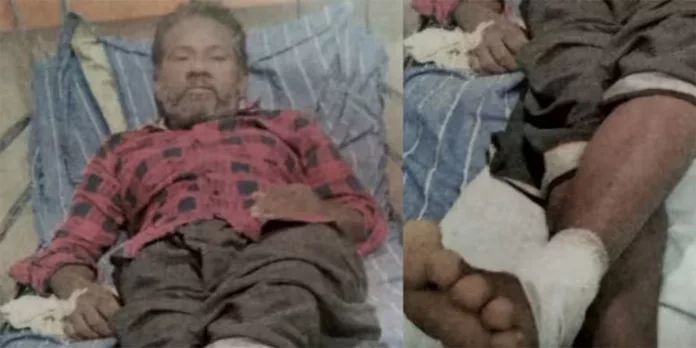 മുഖത്ത് മുളക് പൊടി വിതറി ; പ്രഭാത നടത്തത്തിനിറങ്ങിയ ആള്ക്കുനേരെ ഗുണ്ടാ ആക്രമണം മുഖത്ത് മുളക് പൊടി വിതറി ; പ്രഭാത നടത്തത്തിനിറങ്ങിയ ആള്ക്കുനേരെ ഗുണ്ടാ ആക്രമണം
