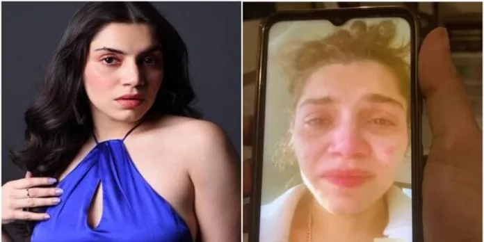 ടോയ്ലറ്റ് വെള്ളം കൊണ്ട് കാപ്പി ഉണ്ടാക്കി : ഷാർജ ജയിലിലെ ദുരവസ്ഥ വിവരിച്ച് നടി ടോയ്ലറ്റ് വെള്ളം കൊണ്ട് കാപ്പി ഉണ്ടാക്കി : ഷാർജ ജയിലിലെ ദുരവസ്ഥ വിവരിച്ച് നടി