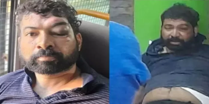 ഡോ.വന്ദന ദാസ് കൊലക്കേസ് ; പ്രതി സന്ദീപിനെ ക്രൈം ബ്രാഞ്ച് കസ്റ്റഡിയിൽ വിട്ടു ഡോ.വന്ദന ദാസ് കൊലക്കേസ് ; പ്രതി സന്ദീപിനെ ക്രൈം ബ്രാഞ്ച് കസ്റ്റഡിയിൽ വിട്ടു