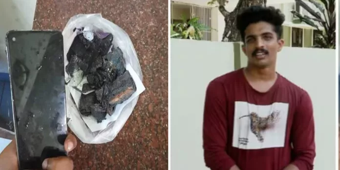 പൊട്ടിത്തെറിച്ചത് രണ്ട് വർഷം മുമ്പ് വാങ്ങിയ റിയൽമി ഫോൺ ; യുവാവ് ചികിത്സയിൽ പൊട്ടിത്തെറിച്ചത് രണ്ട് വർഷം മുമ്പ് വാങ്ങിയ റിയൽമി ഫോൺ ; യുവാവ് ചികിത്സയിൽ