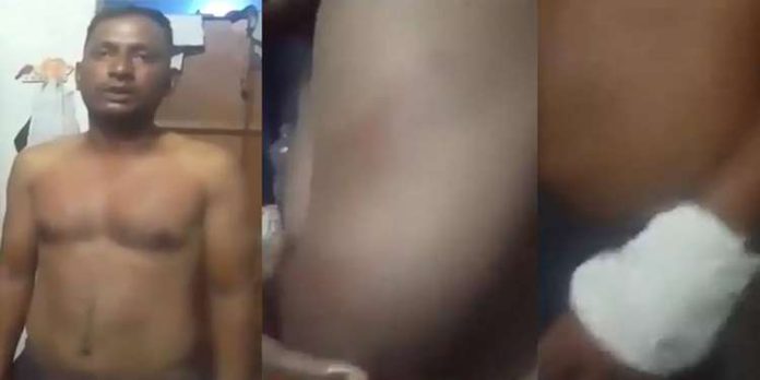 പള്ളിയിൽ കയറുമ്പോൾ ഷൂസഴിക്കാൻ പറഞ്ഞു ; യു.പിയിൽ മുസ്ലിം യുവാവിനെ പോലീസ് ക്രൂരമായി മർദിച്ചെന്ന് പരാതി പള്ളിയിൽ കയറുമ്പോൾ ഷൂസഴിക്കാൻ പറഞ്ഞു ; യു.പിയിൽ മുസ്ലിം യുവാവിനെ പോലീസ് ക്രൂരമായി മർദിച്ചെന്ന് പരാതി