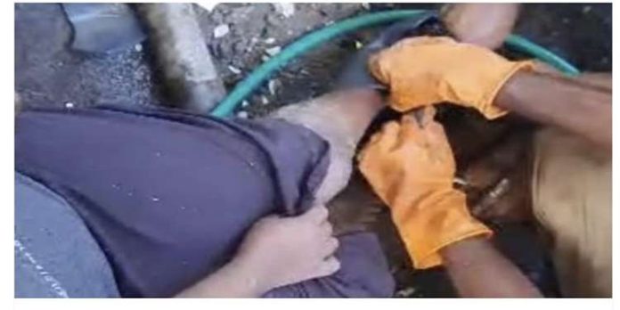 ക്ലോസറ്റിൽ അകപ്പെട്ട യുവതിയുടെ കാൽ അഗ്നി രക്ഷാസേന പുറത്തെടുത്തു ക്ലോസറ്റിൽ അകപ്പെട്ട യുവതിയുടെ കാൽ അഗ്നി രക്ഷാസേന പുറത്തെടുത്തു