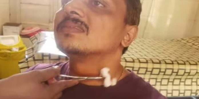 കൊച്ചിയില് കേബിള് കഴുത്തില് കുരുങ്ങി ബൈക്ക് യാത്രികന് പരുക്ക് കൊച്ചിയില് കേബിള് കഴുത്തില് കുരുങ്ങി ബൈക്ക് യാത്രികന് പരുക്ക്