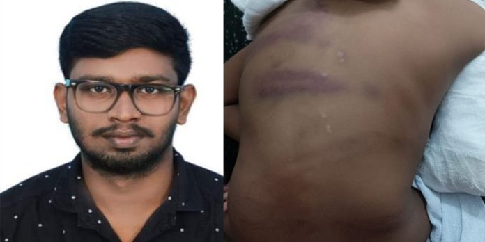 നെയ്യാറ്റിൻകരയിൽ അഞ്ചുവയസുകാരനെ ക്രൂരമായി മർദിച്ച രണ്ടാനച്ഛൻ പിടിയില് നെയ്യാറ്റിൻകരയിൽ അഞ്ചുവയസുകാരനെ ക്രൂരമായി മർദിച്ച രണ്ടാനച്ഛൻ പിടിയില്