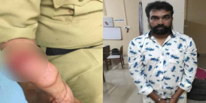 കാസർകോഡ് എക്സൈസ് ഉദ്യോഗസ്ഥന്റെ കൈ പ്രതി കടിച്ചു മുറിച്ചു കാസർകോഡ് എക്സൈസ് ഉദ്യോഗസ്ഥന്റെ കൈ പ്രതി കടിച്ചു മുറിച്ചു