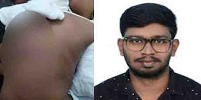 മദ്യപിച്ചെത്തി അഞ്ചു വയസുകാരനെ ക്രൂരമായി മര്ദിച്ച രണ്ടാനച്ഛന് പിടിയില് മദ്യപിച്ചെത്തി അഞ്ചു വയസുകാരനെ ക്രൂരമായി മര്ദിച്ച രണ്ടാനച്ഛന് പിടിയില്