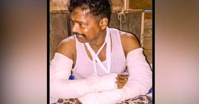 തെരുവുനായ് വട്ടംചാടിയതിനെ തുടർന്ന് റോഡിൽ വീണു ; ബൈക്ക് യാത്രക്കാരന് പരിക്ക് തെരുവുനായ് വട്ടംചാടിയതിനെ തുടർന്ന് റോഡിൽ വീണു ; ബൈക്ക് യാത്രക്കാരന് പരിക്ക്