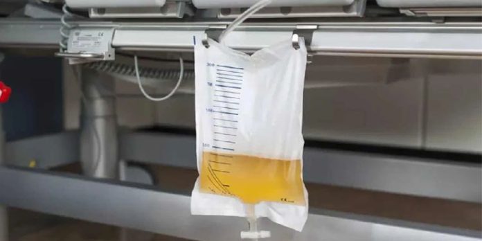 രോഗിക്ക് യൂറിന് ബാഗിന് പകരം സ്പ്രൈറ്റ് കുപ്പി ഉപയോഗിച്ചതായി ആരോപണം രോഗിക്ക് യൂറിന് ബാഗിന് പകരം സ്പ്രൈറ്റ് കുപ്പി ഉപയോഗിച്ചതായി ആരോപണം