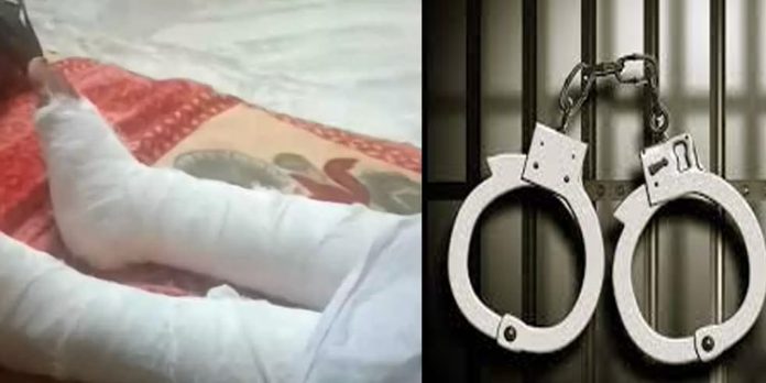 താമരശ്ശേരിയില് ഭാര്യയുടെ കൈകാലുകള് തല്ലിയൊടിച്ചു ; ഭര്ത്താവ് അറസ്റ്റില് താമരശ്ശേരിയില് ഭാര്യയുടെ കൈകാലുകള് തല്ലിയൊടിച്ചു ; ഭര്ത്താവ് അറസ്റ്റില്