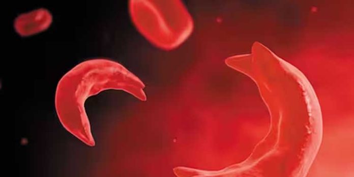 അരിവാള് രോഗികളോട് സര്ക്കാരിന്റെ ഇരട്ടിപ്രഹരം ; അടിയന്തിര ചികിത്സയോട് പോലും മുഖംതിരിച്ച് സര്ക്കാര് അരിവാള് രോഗികളോട് സര്ക്കാരിന്റെ ഇരട്ടിപ്രഹരം ; അടിയന്തിര ചികിത്സയോട് പോലും മുഖംതിരിച്ച് സര്ക്കാര്