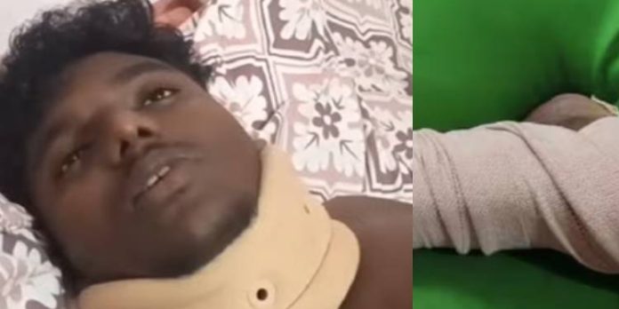 വിദ്യാർത്ഥിയെ എബിവിപി പ്രവർത്തകർ ക്രൂരമായി മർദിച്ചെന്ന് പരാതി വിദ്യാർത്ഥിയെ എബിവിപി പ്രവർത്തകർ ക്രൂരമായി മർദിച്ചെന്ന് പരാതി
