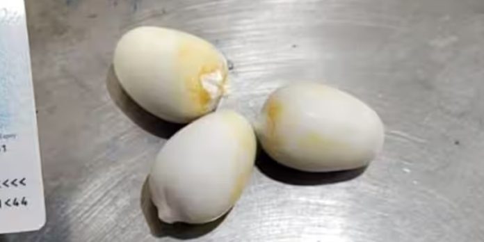 ശരീരത്തില് ഒളിപ്പിച്ച് കടത്താന് ശ്രമിച്ച സ്വര്ണവുമായി യാത്രക്കാരൻ പിടിയിൽ ശരീരത്തില് ഒളിപ്പിച്ച് കടത്താന് ശ്രമിച്ച സ്വര്ണവുമായി യാത്രക്കാരൻ പിടിയിൽ