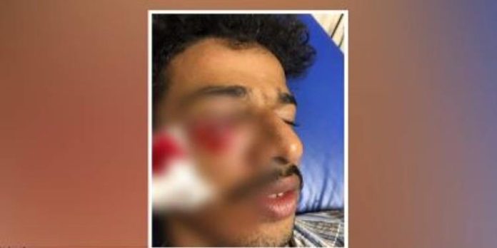 ചാത്തമംഗലം എംഇഎസ് ആർട്സ് ആൻഡ് സയൻസ് കോളേജിൽ വിദ്യാർത്ഥിക്ക് റാഗിങ്ങിൽ ക്രൂരമർദ്ദനം ചാത്തമംഗലം എംഇഎസ് ആർട്സ് ആൻഡ് സയൻസ് കോളേജിൽ വിദ്യാർത്ഥിക്ക് റാഗിങ്ങിൽ ക്രൂരമർദ്ദനം