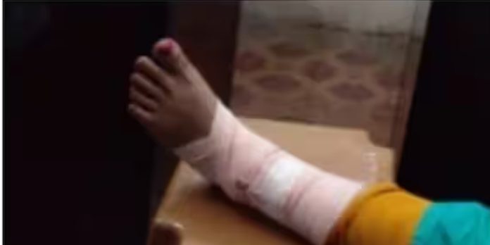 നടന്നുപോകുമ്പോൾ കാൽ സ്ലാബിനടിയിൽ കുടുങ്ങി ; യുവതിക്ക് ഗുരുതര പരിക്ക് നടന്നുപോകുമ്പോൾ കാൽ സ്ലാബിനടിയിൽ കുടുങ്ങി ; യുവതിക്ക് ഗുരുതര പരിക്ക്