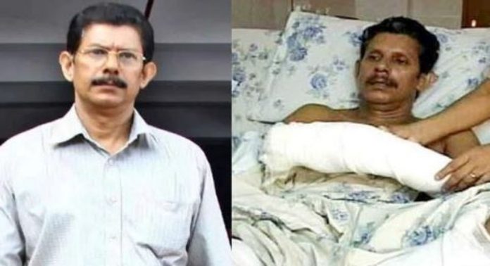 അധ്യാപകന്റെ കൈപ്പത്തി വെട്ടിമാറ്റിയ കേസ് ; ഒടുവിൽ വർഷങ്ങളായി ഒളിവിൽ കഴിഞ്ഞിരുന്ന മുഖ്യപ്രതി അറസ്റ്റിൽ, പ്രതിയെ എന്ഐഎ കോടതിയില് ഹാജരാക്കും അധ്യാപകന്റെ കൈപ്പത്തി വെട്ടിമാറ്റിയ കേസ് ; ഒടുവിൽ വർഷങ്ങളായി ഒളിവിൽ കഴിഞ്ഞിരുന്ന മുഖ്യപ്രതി അറസ്റ്റിൽ, പ്രതിയെ എന്ഐഎ കോടതിയില് ഹാജരാക്കും