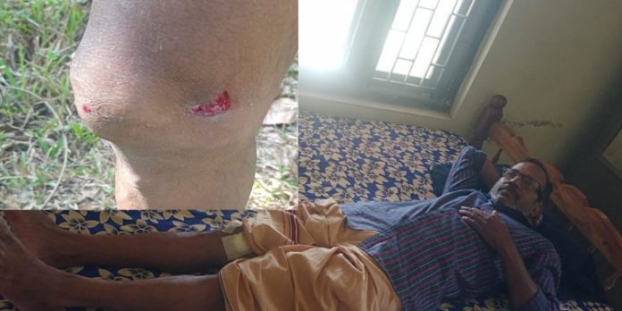 കോന്നി സിഎഫ്ആര്ഡി വളപ്പില് പന്നിയുടെ ആക്രമണം ; ഡ്രൈവര്ക്ക് പരിക്ക് കോന്നി സിഎഫ്ആര്ഡി വളപ്പില് പന്നിയുടെ ആക്രമണം ; ഡ്രൈവര്ക്ക് പരിക്ക്