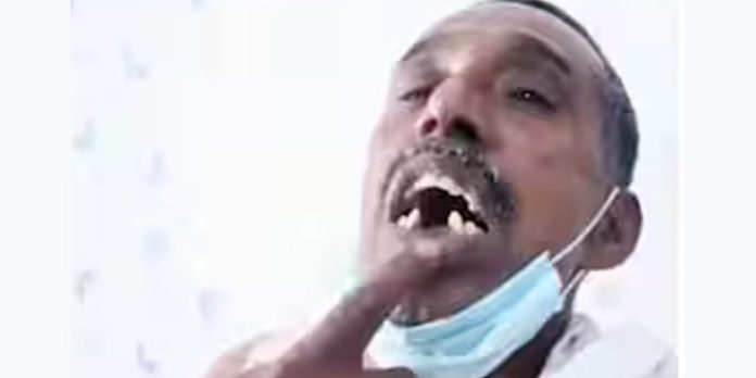 പോലീസ് ഉദ്യോഗസ്ഥൻ 56കാരന്റെ പല്ലിടിച്ചു കൊഴിച്ചെന്ന് പരാതി പോലീസ് ഉദ്യോഗസ്ഥൻ 56കാരന്റെ പല്ലിടിച്ചു കൊഴിച്ചെന്ന് പരാതി
