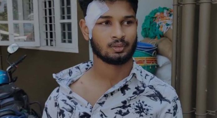 സൊമാറ്റോ ഡെലിവറി ബോയിക്ക് പെട്രോൾ പമ്പ് ജീവനക്കാരുടെ ക്രൂരമർദനം സൊമാറ്റോ ഡെലിവറി ബോയിക്ക് പെട്രോൾ പമ്പ് ജീവനക്കാരുടെ ക്രൂരമർദനം
